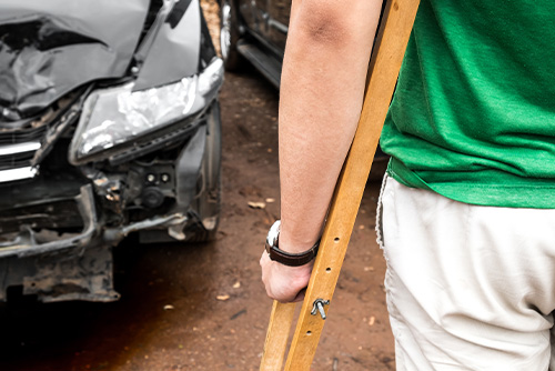 broken bones after a car accident in south carolina